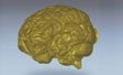 Laser scan of human brain